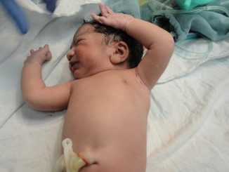 erfahren sie, wie sie die richtige nabelschnurpflege für neugeborene durchführen. tipps zur hygiene, heilung und zur vermeidung von infektionen für einen gesunden start ins leben.